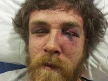 Wisconsin Senator’s Son Beaten to Pulp